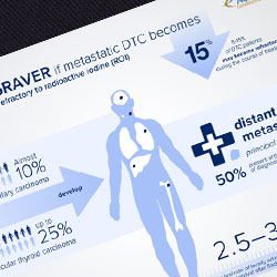 Nexevar Infographics