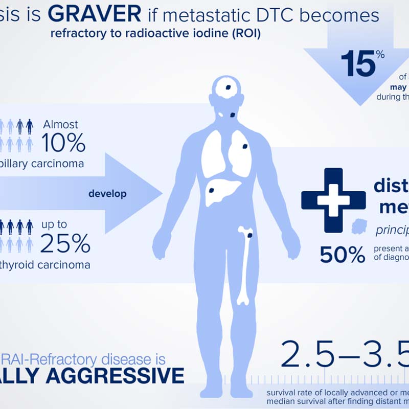 Nexavar Infographics